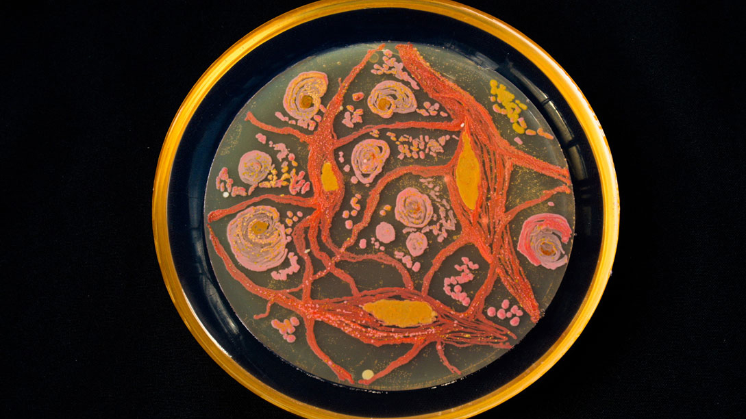 Artist creates “paintings” using bacteria | OverSixty