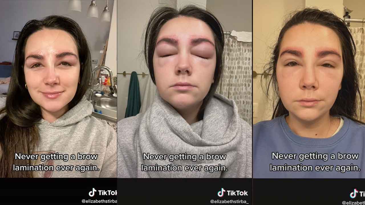 Woman shares terrifying reaction to eyebrow lamination