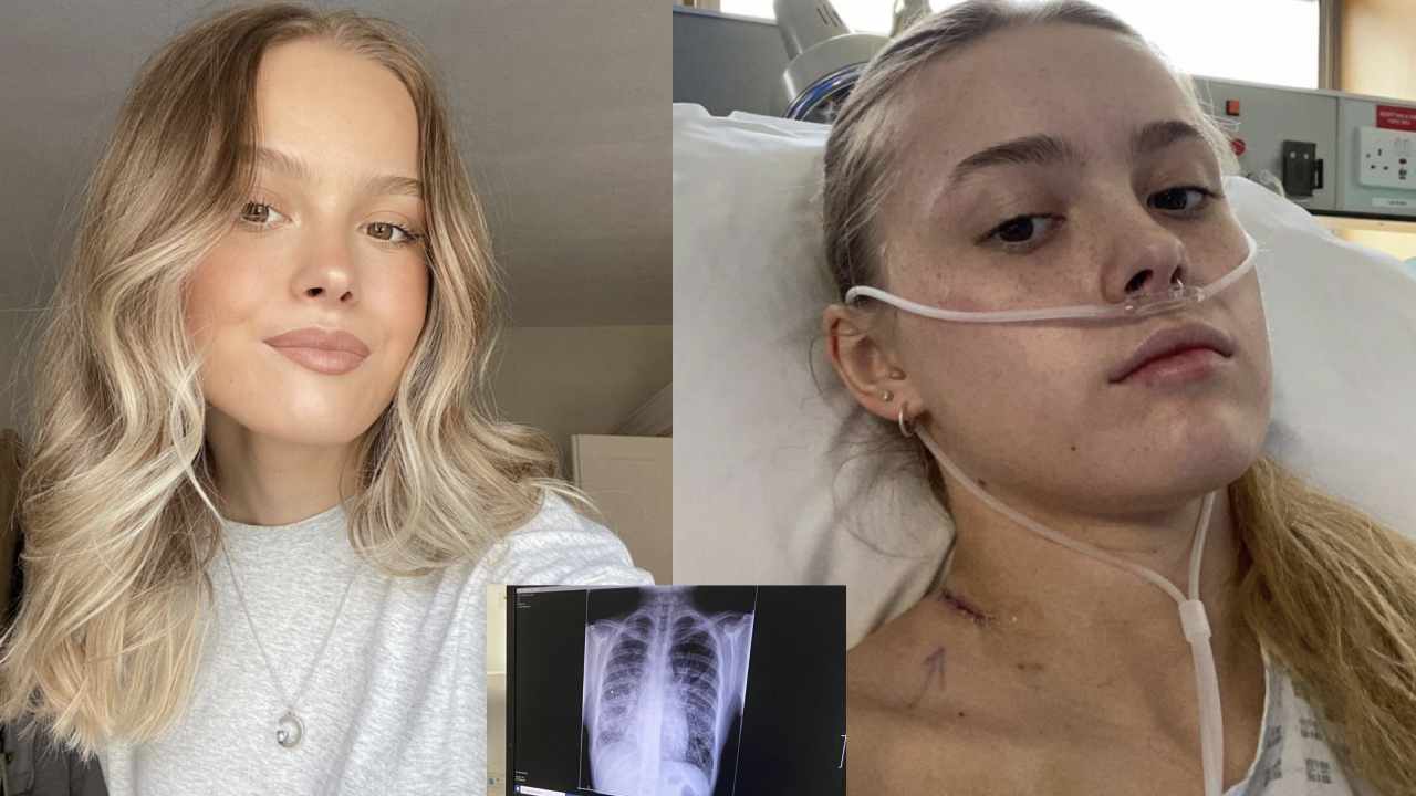 Misdiagnosed student learns she has incurable cancer