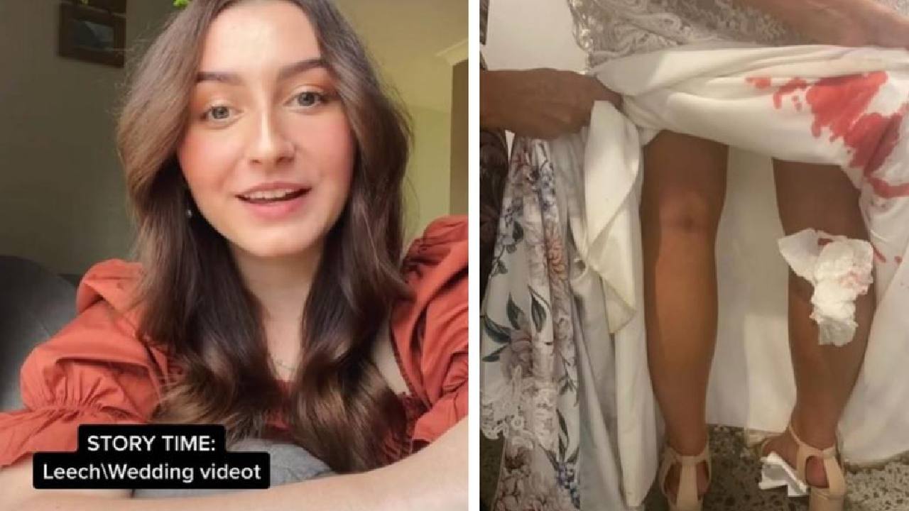 Bride's horror story after discovering bloodstains on her wedding dress﻿
