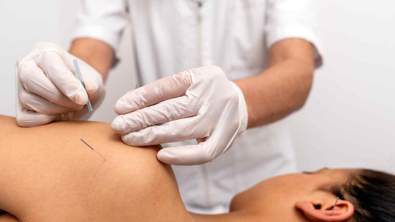 Physio ‘dry needling’ and acupuncture – what’s the difference and what does the evidence say?