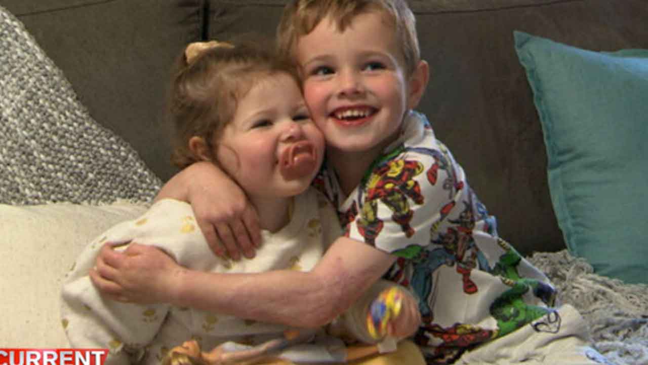 “He’s my hero”: 5-year-old saves baby sister from burning cot