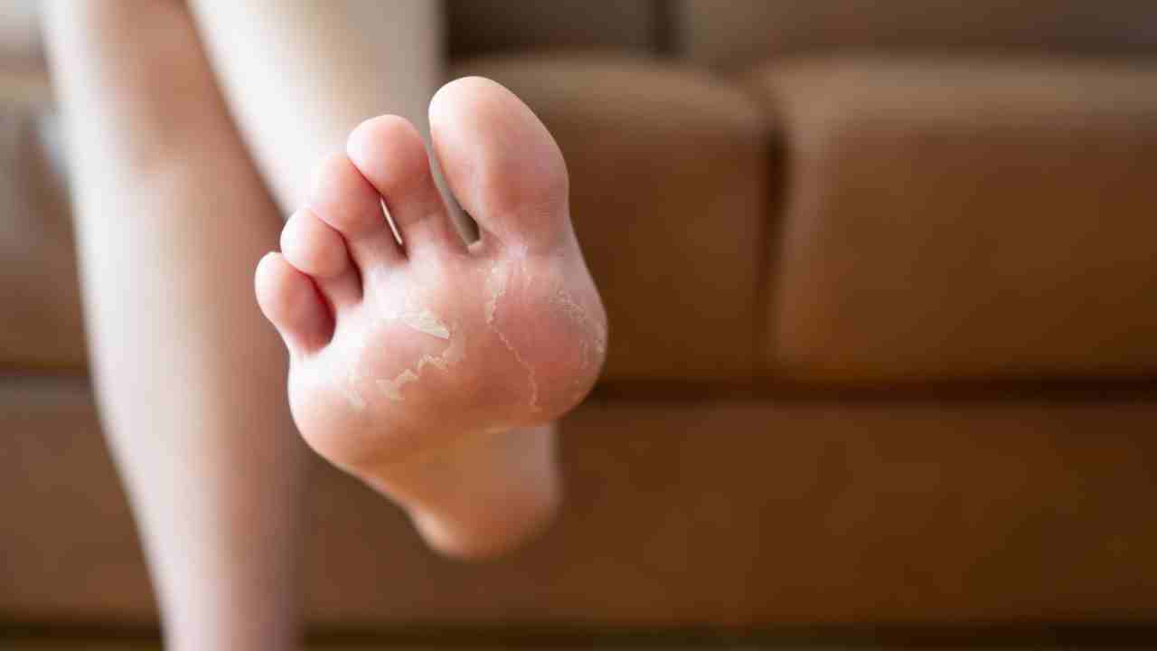 10 subtle signs of disease your feet can reveal