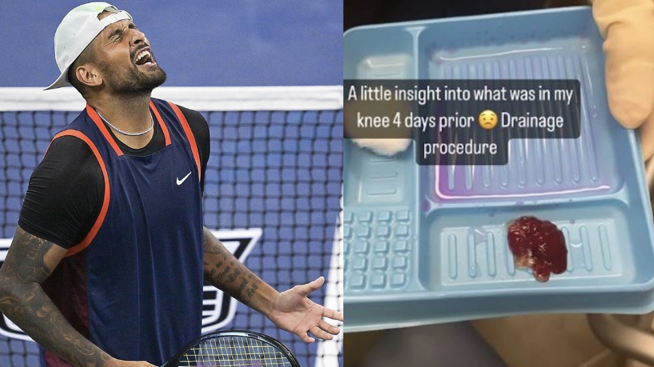 Nick Kyrgios pulls out of Australian Open a day before first match