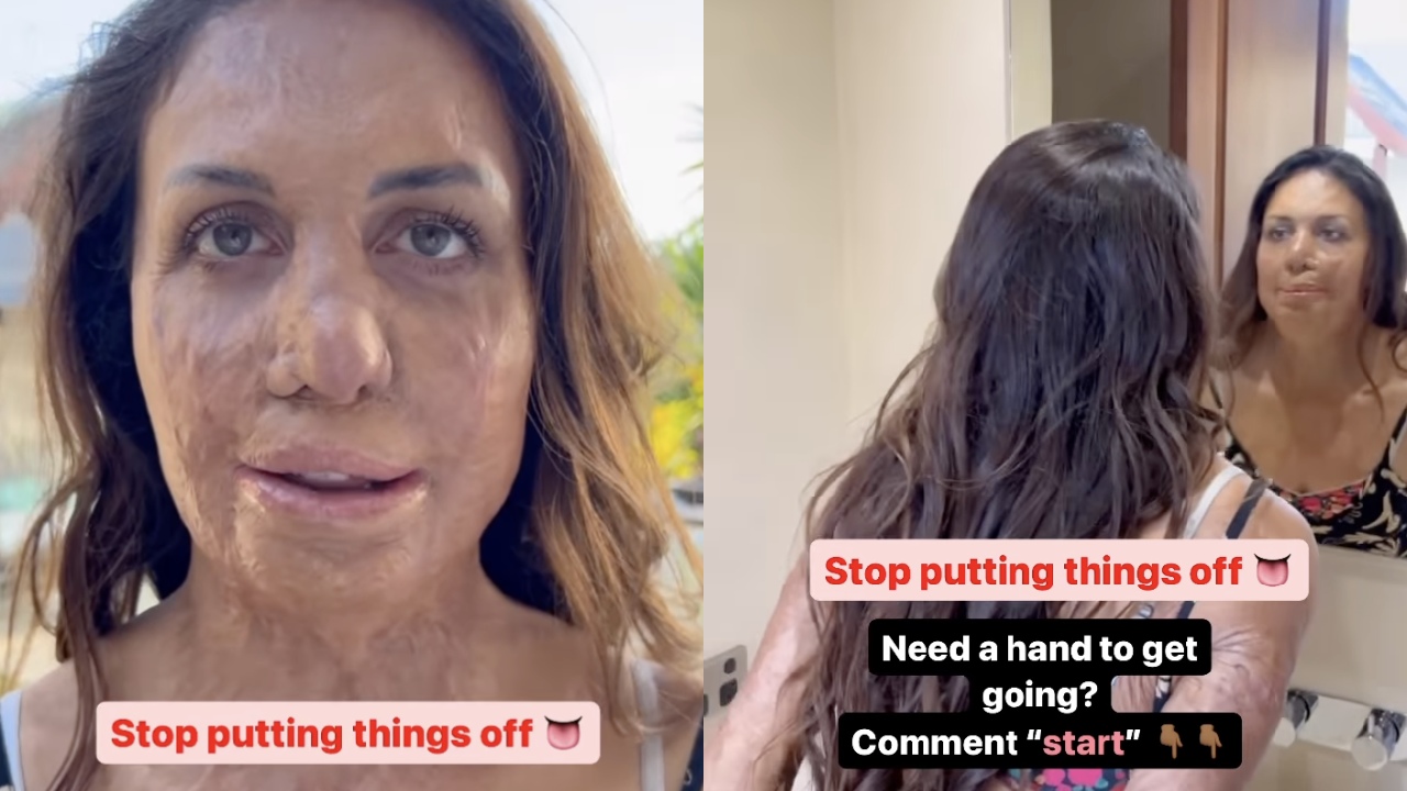 "Stop putting things off”: Turia Pitt warns followers after recent health scare