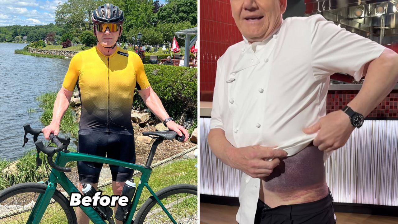 "Lucky to be here": Gordon Ramsay reveals brutal injury after bike crash