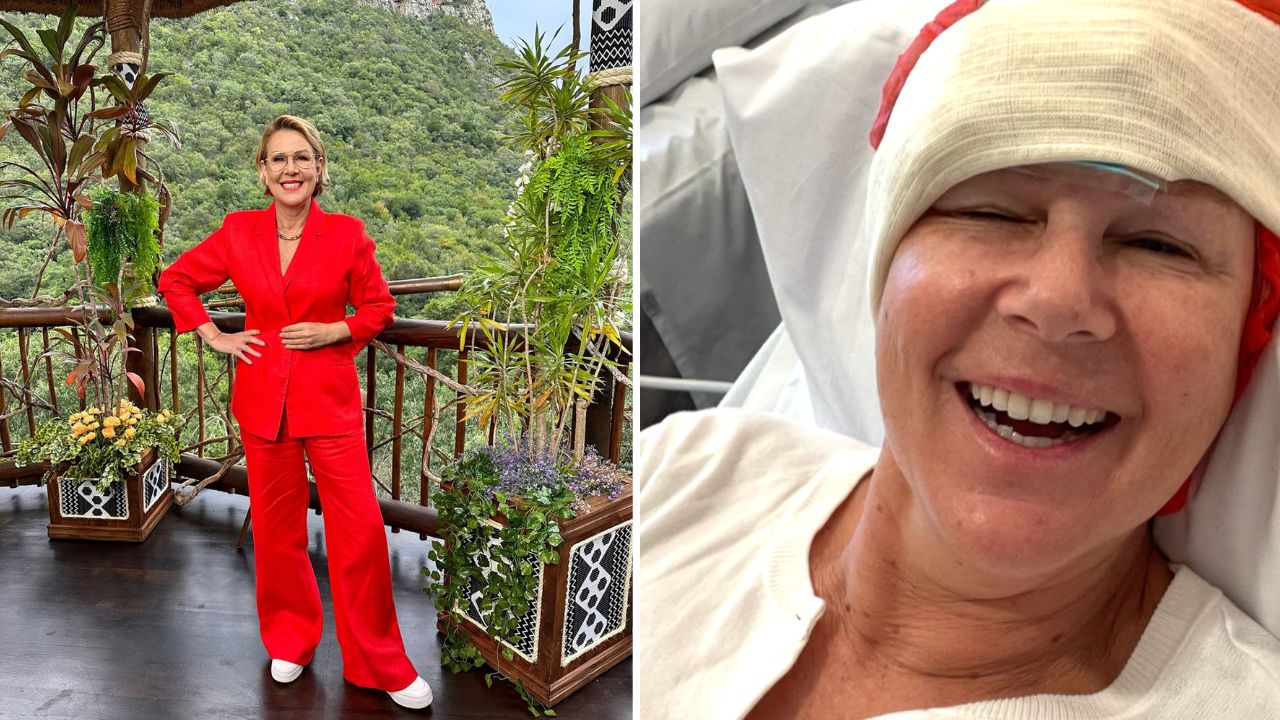 Julia Morris issues urgent warning after skin cancer scare