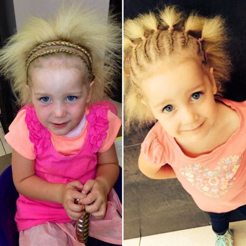 Aussie girl diagnosed with Uncombable Hair syndrome | OverSixty