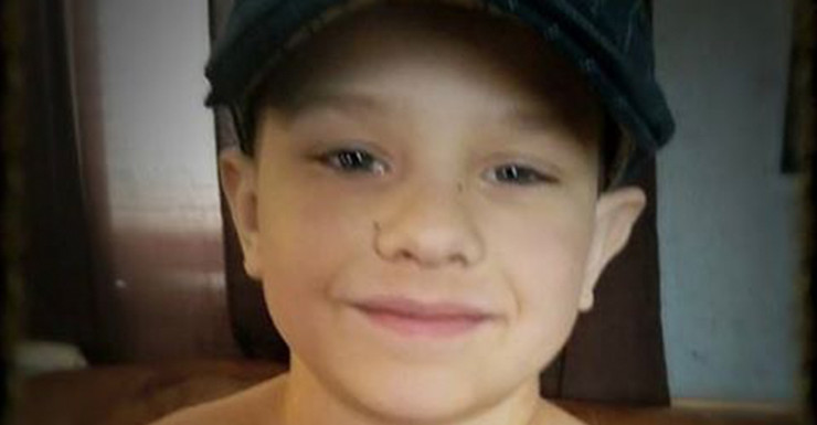 Dad shares photo of son after his heart surgery to show he should be proud of his scars