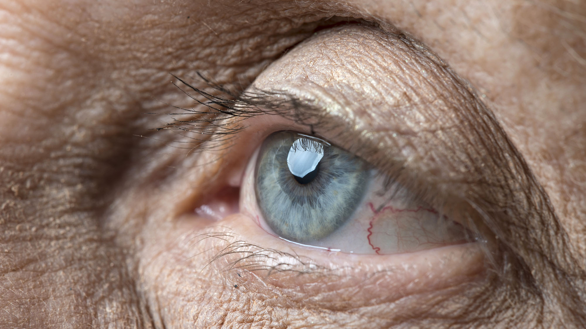 syte on eye syte on eye