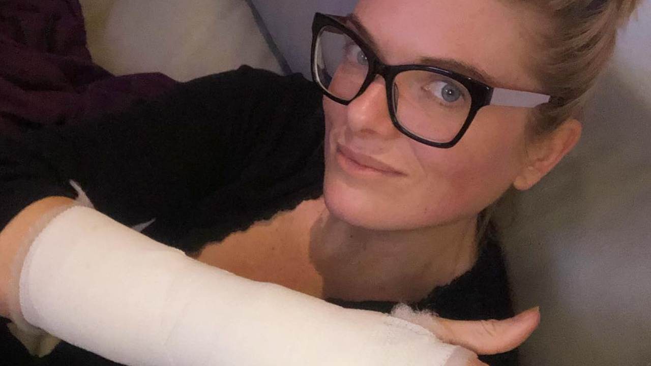 “That bruising is next level”: Erin Molan shares updates on her injury