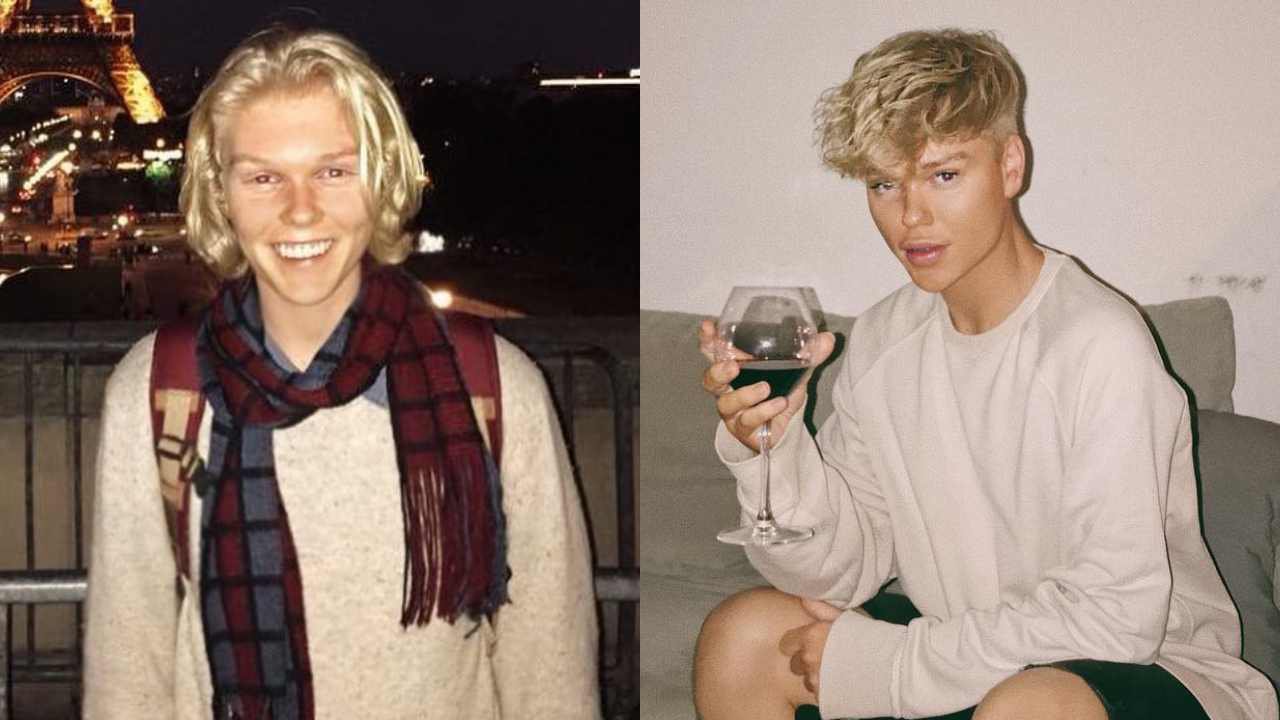 Jack Vidgen FINALLY reveals the truth about his "new face"