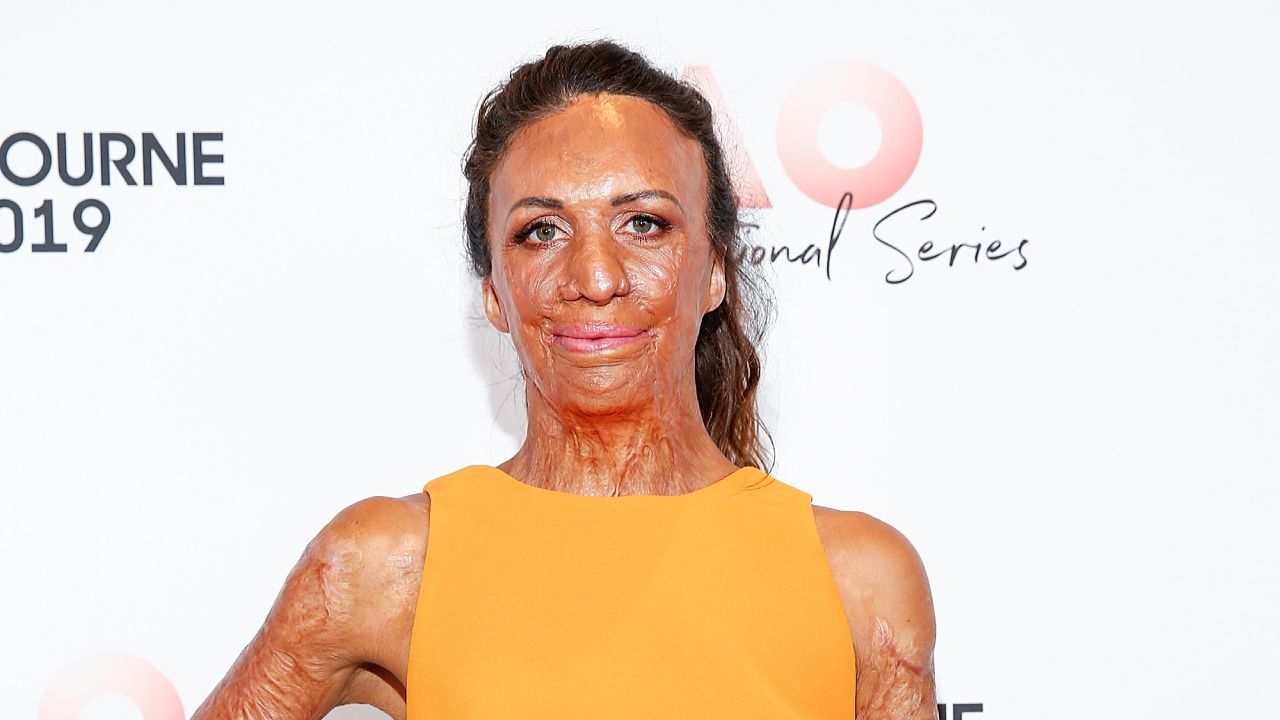 The intimate family pictures of Turia Pitt before the fire that almost took her life