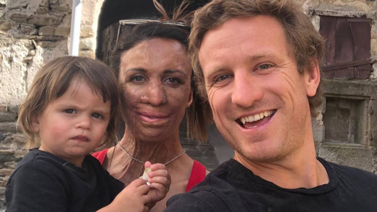 Big news for Turia Pitt as Aussie celebs chime in with their support