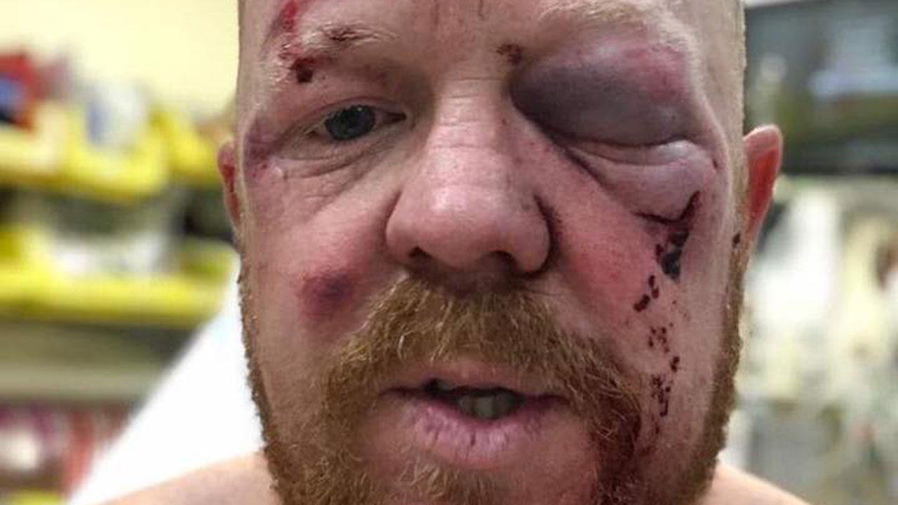 Paramedic bashed during charity ride holds no grudge against teen attackers