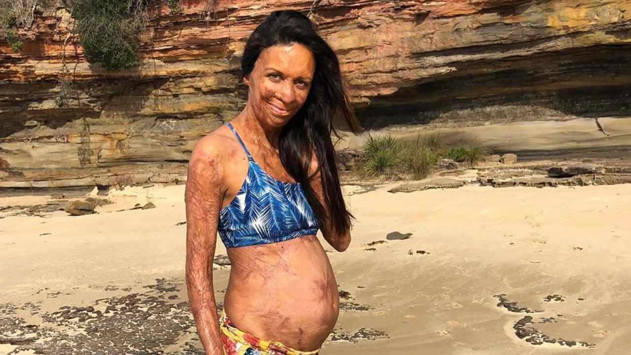 Pregnant Turia Pitt has revealed the joy that motherhood brings to her life