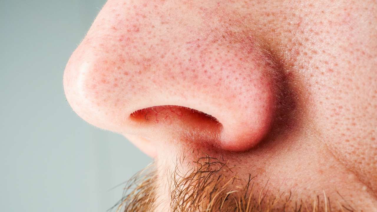 The unbelievable reason for a man's brutal sinus infection