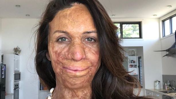 Turia Pitt thanks supporters for giving her their most “precious resource”