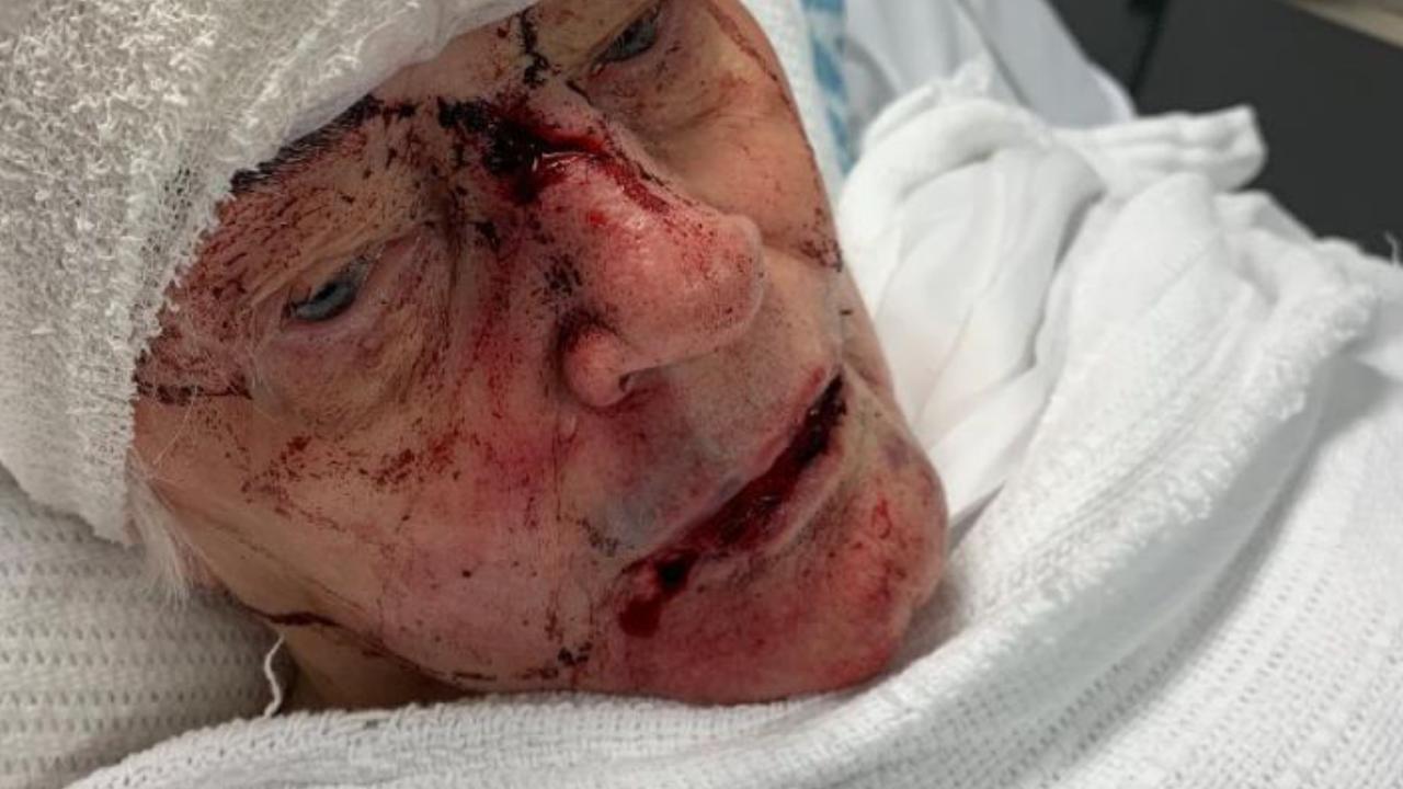 Shocking new details emerge of elderly woman who was bashed at her retirement village