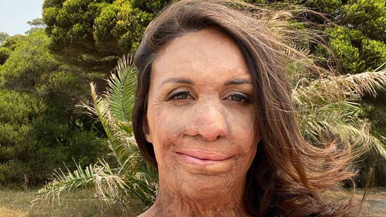 Turia Pitt hints at due date for second child