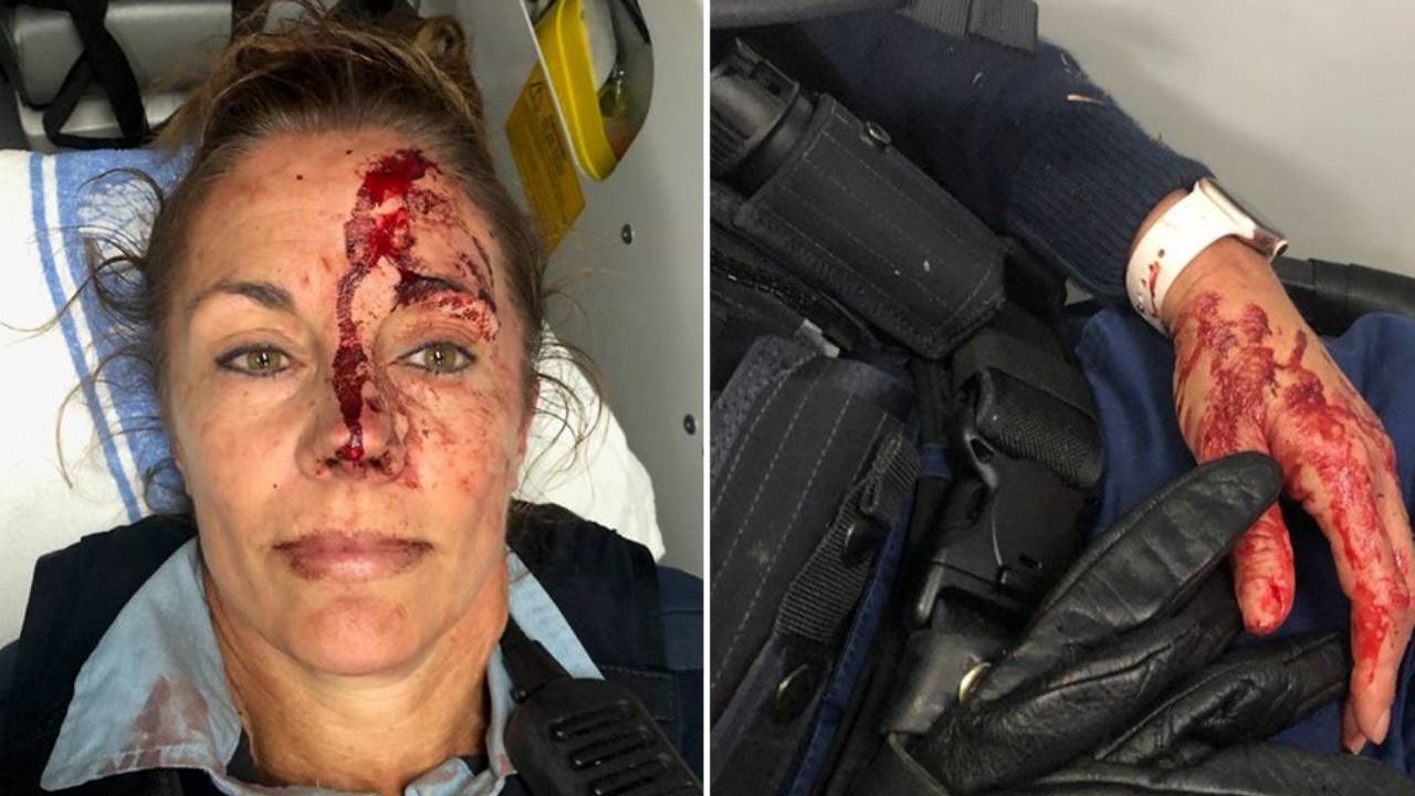 Police officer suffers horrific injuries after being punched in the face