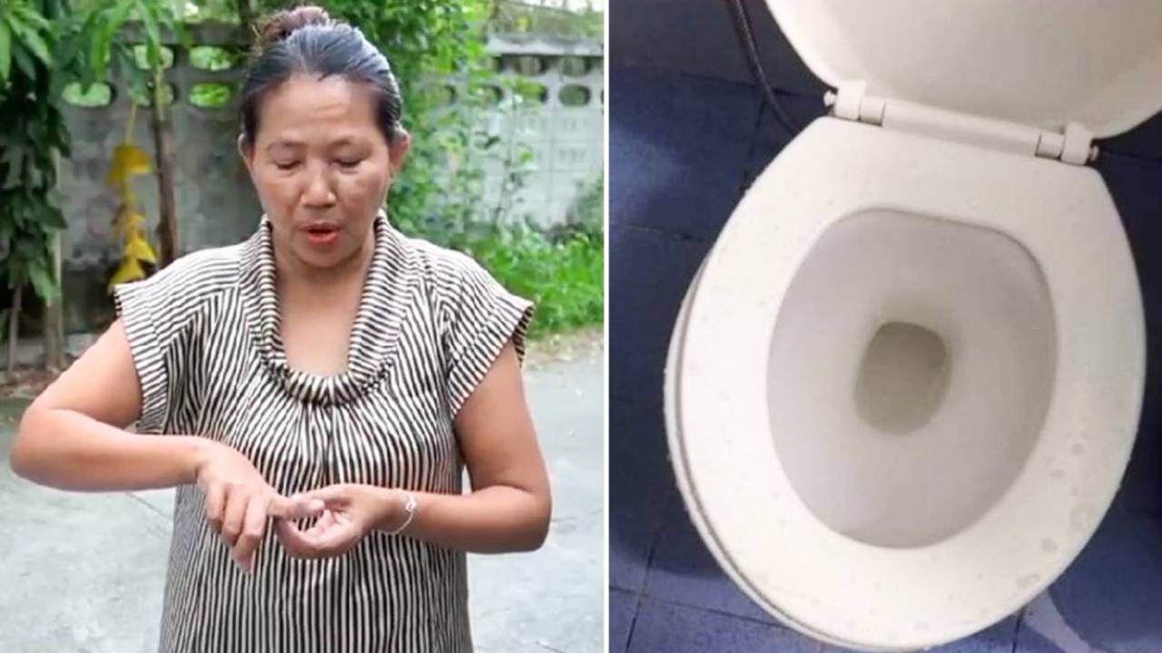 Womens Horrifying Attack After Sitting On Toilet Oversixty 