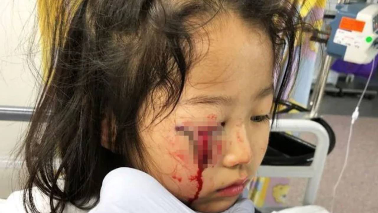 Girl’s horrific eye injury forces safety changes at Target and Kmart