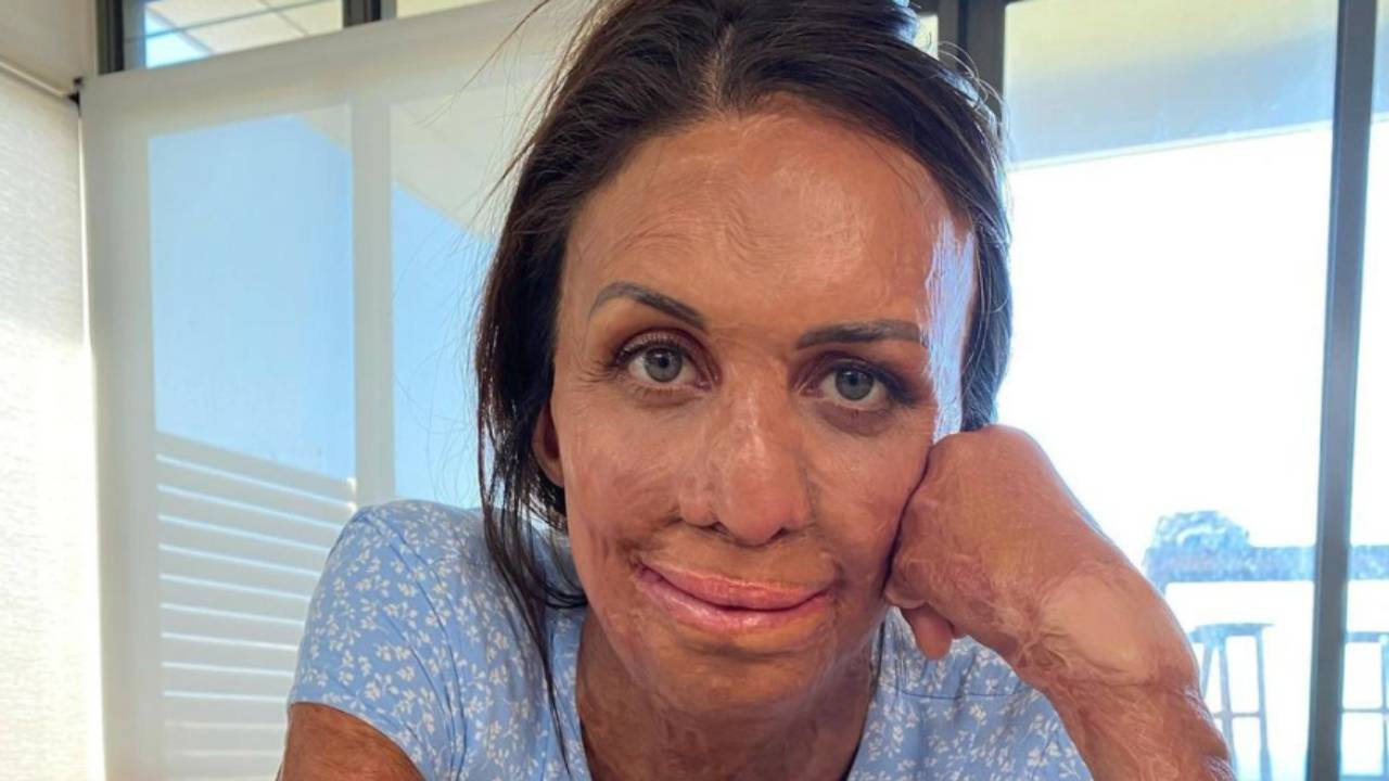 Turia Pitt's revolutionary new venture