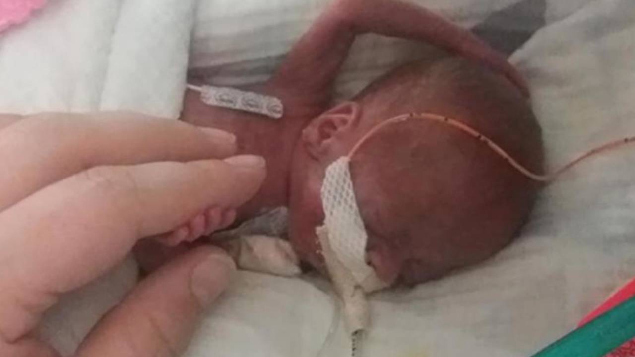 World's most premature baby celebrates first birthday