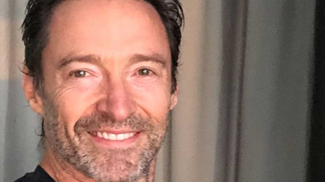 Hugh Jackman calls on fans for tech support