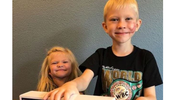 Young boy who saved his sister is "proud" of his scars