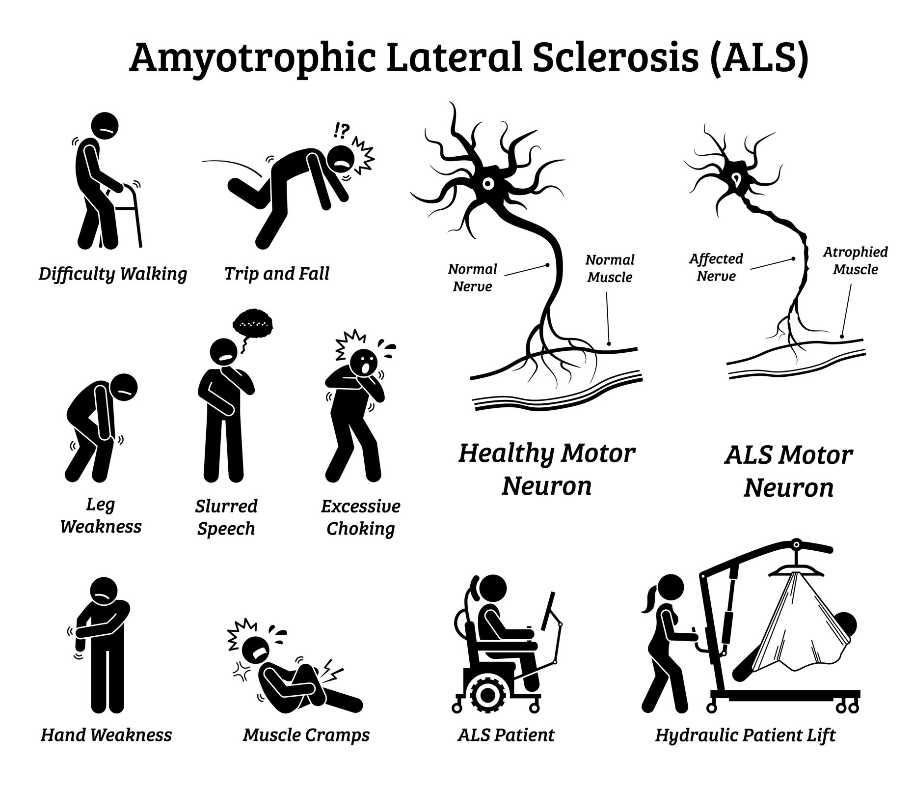 raising-awareness-of-motor-neurone-disease-eximius-support