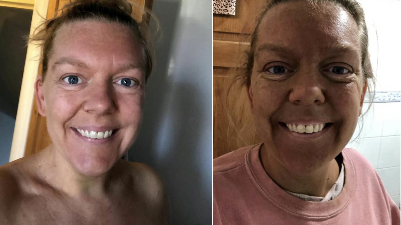 Woman's spray tan disaster goes viral 